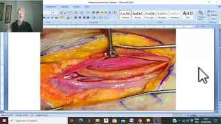 Introduction to anatomy 3 Fascia   by Dr Wahdan [upl. by Rabush70]