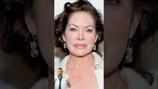 Lara Flynn Boyle Früher vs Heute laraflynnboyle frühervsheute beautydoc hyaluron [upl. by Ande]