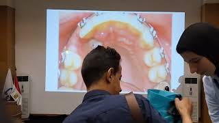 1Fatal mistakes in orthodontic practice first part DrSayed Hafez [upl. by Calley]