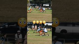 Rugby League’s Most Horrific Accidental Injuries [upl. by Alyks]