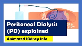 Peritoneal Dialysis explained [upl. by Chesna]