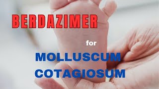 MOLLUSCUM CONTAGIOSUM Treatment update  BERDAZIMER GEL [upl. by Adnana]