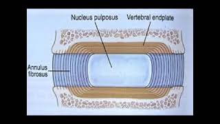 Two Minutes of Anatomy Intervertebral Disc IVD [upl. by Mohkos285]