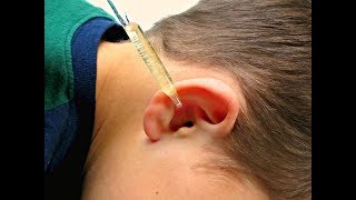 EARACHE GONE in 15 MINUTES using these 3 HOUSEHOLD INGREDIENTS [upl. by Amarillas]