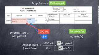 Calculating infusion rates in dropsmin 20 dropsmL [upl. by Elson]