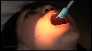 REAL PERSON DENTAL ASMR 3 🦷 EXAM AND TEETH CLEANING [upl. by Athalee]