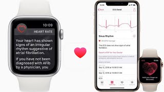 How to Set Apple Watch to Notify High Heart Rate [upl. by Larena]