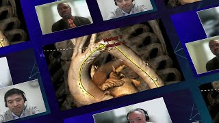 Contemporary challenges of TAVI tailored device selection to the anatomy  Webinar [upl. by Enileuqkcaj164]