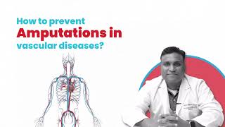 Why Vascular Health Matters The Link to Amputations [upl. by Formenti580]