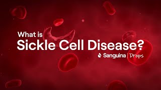 What is Sickle Cell Disease  SanguinaDrops [upl. by Ardnahc905]