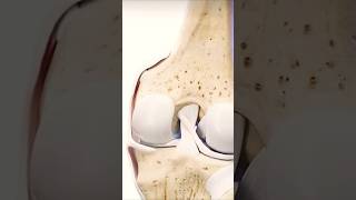 Movement of menisci anterior and posterior cruciate ligament of kneeshortsmedicosshort [upl. by Akihsan]