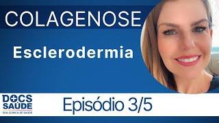 O que é esclerodermia [upl. by Atika]