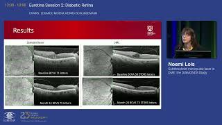 3 Subthreshold micropulse laser in DME the DIAMONDS Study [upl. by Rother]