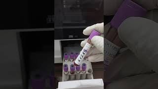 CBC Blood test যেভাবে CBC রক্ত পরিক্ষা করা হয়। [upl. by Seafowl]