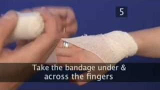 how to bandage a hand [upl. by Nosemyaj500]