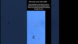 What do Amoebae feed on Amoeba under the microscope microscopy [upl. by Elocin]