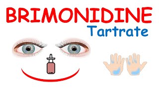 Brimonidine tartrate eye drops [upl. by Sergio]