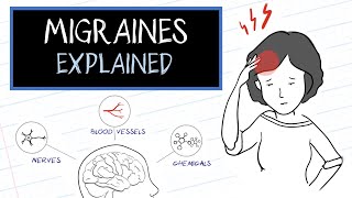 What are Migraines HealthSketch [upl. by Mcdowell61]