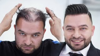 Thinning Haircut Transformation l Makeover for special Occasion [upl. by Assisi]