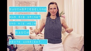 Bauchspiegelung was sie bringt und wie mein Bauch heute aussieht [upl. by Elyad326]