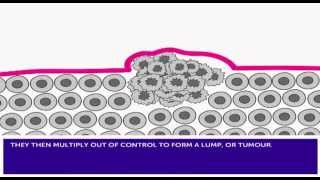 How Cancer Develops amp Mutation [upl. by Lawton]