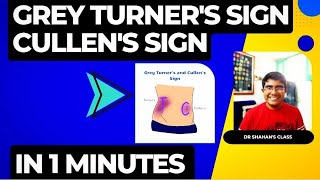 Grey Turners and Cullens Sign  in 1 minute [upl. by Osrick136]