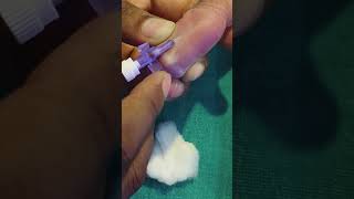 Cannulation technique in neonatal injection newborn niculife [upl. by Smaj984]