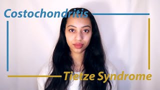 My Experience With Costochondritis Tietze Syndrome [upl. by Pharaoh]