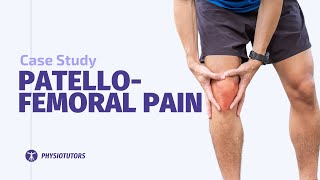 Patellofemoral Pain Case Study [upl. by Akimehs358]