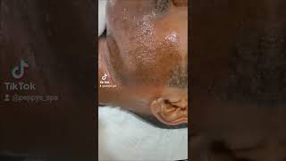 Chin waxing help to remove hair from the roots spavideo waxingtutorial facialhairremoval waxing [upl. by Nazus]