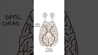 Bitemporal Hemianopia medicine clinicalexamination ophthalmology [upl. by Lennon]