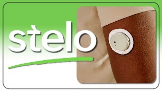 New Dexcom Stelo CGM amp G7 Updates  I Asked Your Questions [upl. by Aicelaf137]