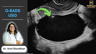 Demystifying ORADS  Ultrasound  Dr Avni Skandhan  July 2021 [upl. by Ng]