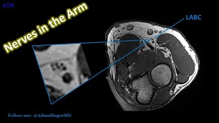 High Resolution MRI Anatomy of Major Nerves in the Arm [upl. by Persas]