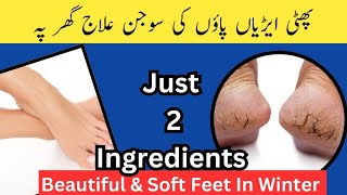 Crack Heels Treatment at Home پھٹی ایڑیاں بنائیں نرم و نازک اب گھر پہ [upl. by Nosyla]