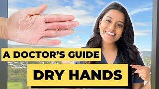 Dry hands Eczema 👋🏽 5 Tips for Smooth and Hydrated Hands 🙌 [upl. by Emory243]