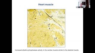 Myositis and Heart Disease with Dr Christina CharlesSchoeman [upl. by Kennith157]