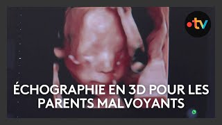 Une échographie en 3D pour les parents malvoyants [upl. by Liban622]