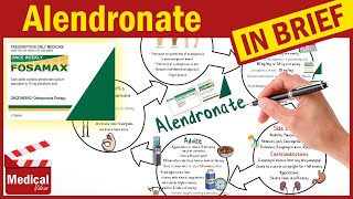 Alendronate Sodium 70 mg Fosamax What is Alendronate used for Fosamax Uses Dosage Side Effects [upl. by Chon]