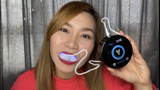 VIAILA TEETH COLD LIGHT WHITENING REVIEW  Cherry Leonidas Vlogs [upl. by Caitrin]