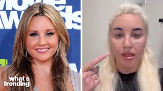 Amanda Bynes REVEALS Why She Got Eyelid Surgery [upl. by Ignacius]