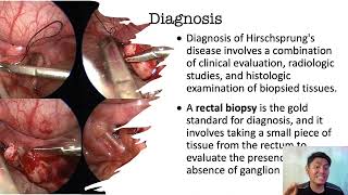 Understanding Hirschsprungs Disease for Midwifery and Nursing Students [upl. by Aivitnahs]