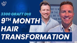 LifeChanging DHI Hair Transplant Transformation After 9 Months [upl. by Ehgit]