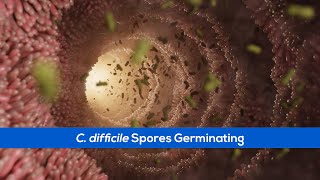 C Difficile Infection  Germination of Spores in the Small Intestine [upl. by Tavy573]