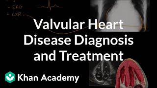 Valvular heart disease diagnosis and treatment  NCLEXRN  Khan Academy [upl. by Ydniahs92]