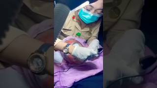 Dermapen  PRP shorts shortvideo pejuangacne apt [upl. by Adnuhsed177]