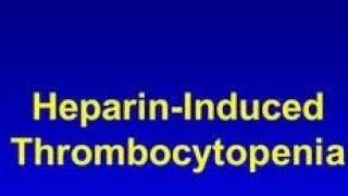 HEPARIN INDUCED THROMBOCYTOPENIA  HIT medical learnings  practical learnings [upl. by Rior]