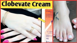 Clobevate Hand amp Foot Whitening Cream Best Formula whitening cream for handsAmazing Results [upl. by Aciraj]