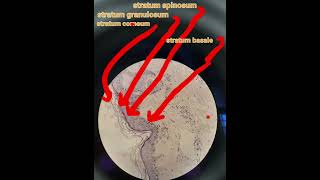 Layers of epidermisskindermapathHandEhistologypathologymedical [upl. by Nell]