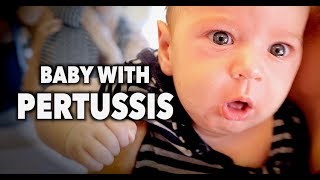 BABY WITH PERTUSSIS Whooping Cough  Dr Paul [upl. by Nnylhtak395]